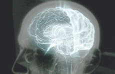 L’epigenoma del cervell canvia des del naixement fins a l’adolescència