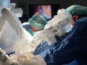 Realizan la primera extracción en el mundo de una costilla mediante cirugía robótica y una sola incisión