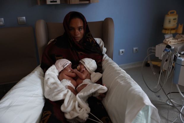 El Hospital Sant Joan de Déu intervendrá a gemelas siamesas para salvar sus vidas