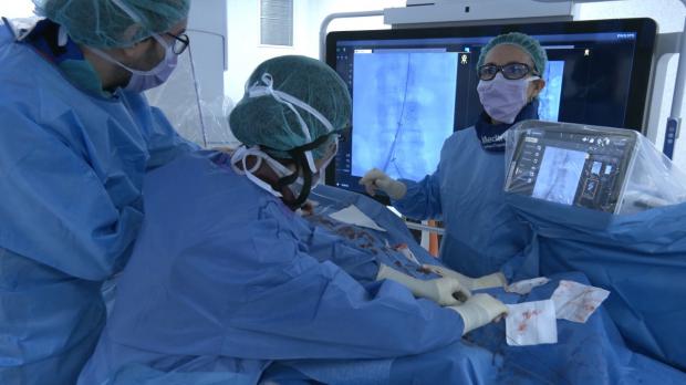 El Hospital Universitario de Bellvitge (HUB), con el liderazgo del Servicio de Angiología y Cirugía Vascular, ha creado el protocolo "Código Aorta", que permitirá reducir la mortalidad en pacientes con ruptura de la aorta abdominal.