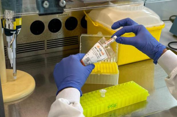 Bellvitge lidera el desarrollo del primer test de sangre capaz de anticipar la demencia del Alzheimer