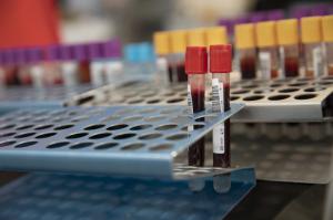 Martorell acogerá dos campañas de donación de sangre en sus hospitales