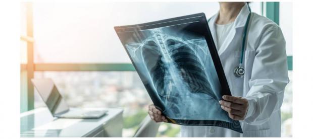 Bellvitge impulsa un avance clave en la lucha contra la fibrosis pulmonar post-COVID